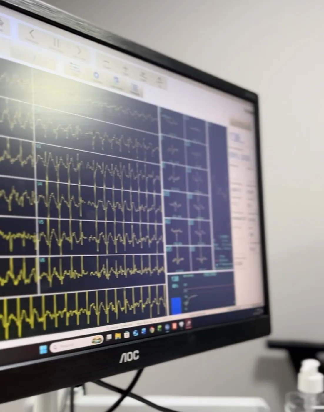 Monitor com eletrocardiograma de 12 derivações durante teste de esforço — cardiologia do esporte no IEMEX Performance, Curitiba