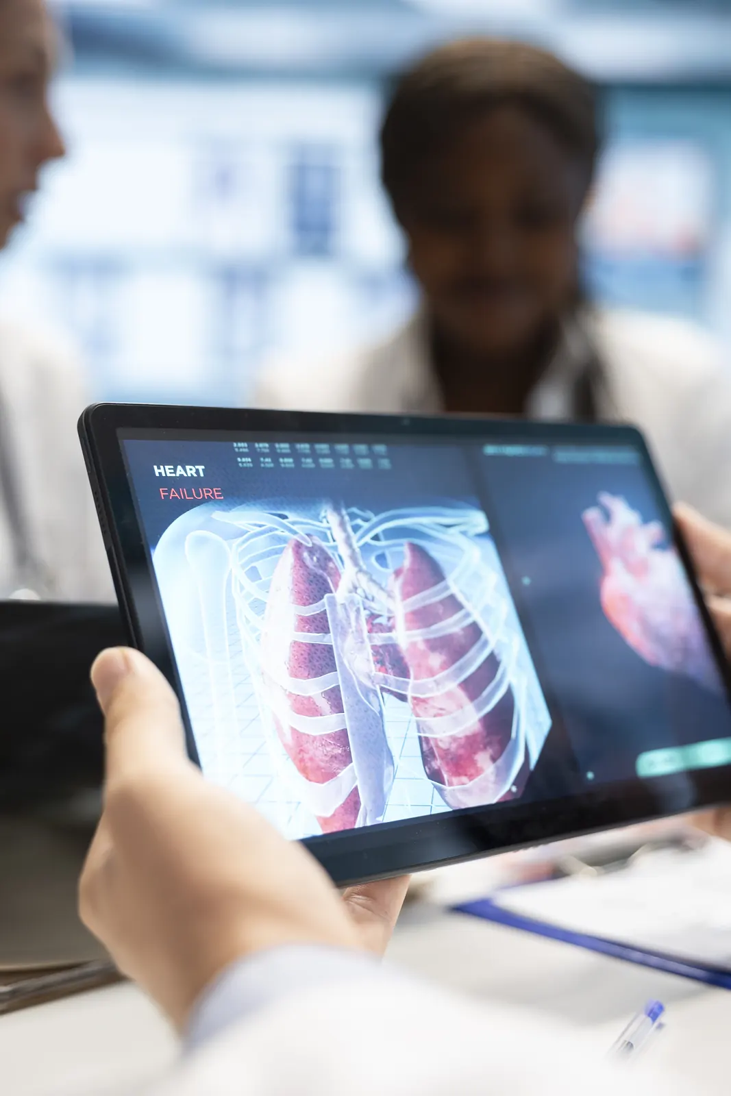 Avaliação da função pulmonar no teste de broncoprovocação — IEMEX Performance, Curitiba